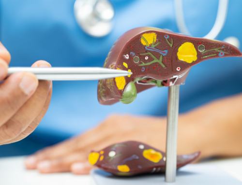 Μη αλκοολική Λιπώδης Νόσος του Ήπατος (NAFLD) και Διατροφή